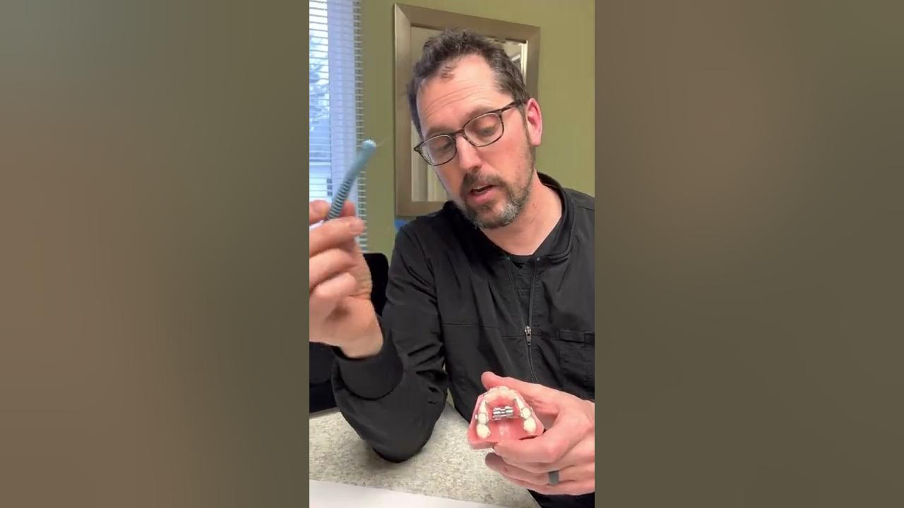 Expander Key Turning Instructions YouTube