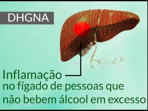 Vídeo: Nafld é considerada doença hepática?