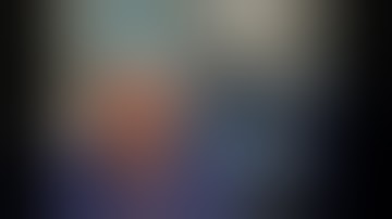 Full length robotic radical prostatectomy | How I do it | Prof Declan Murphy