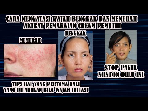 Video: Bermakna Untuk Mencegah Pembengkakan Wajah