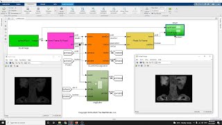 FPGA HDL Implementation of   Contrast Limited Adaptive Histogram Equalization (CLAHE) Using Simulink