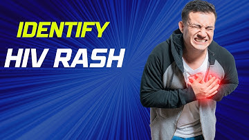 Doctor explains how to Identify HIV rash symptoms