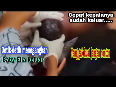 Detik-detik baby Ella keluar -  kepalanya kelihatan