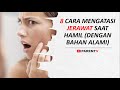Rahasia Cepat Atasi Jerawat Saat Hamil