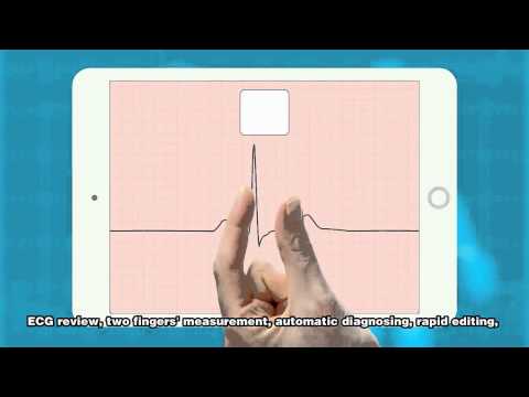iCardioView ECG for