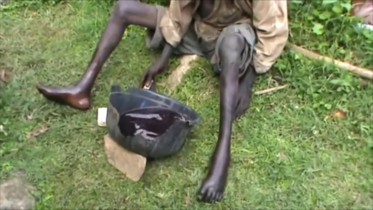 Tragic Jigger Removal Story! Simeon's Battle with Jiggers and More