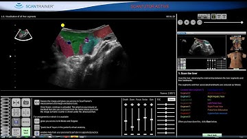 ScanTutor video teaching visualisation of liver segments - General Medical Module