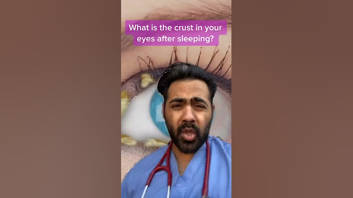 Weird crust in eyes after sleeping! #shorts