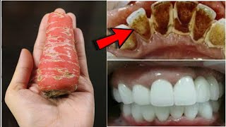 In 2 minutes, yellow will make dirty teeth white like pearl and shiny.Home remedy for teeth whitenin