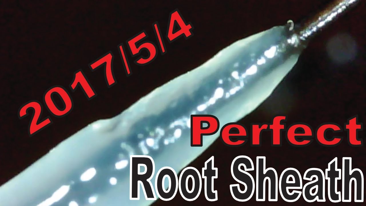 Hair Root Close Up Part 47 完全毛根鞘 透明なやつ 豊作 Bumper Crop Perfect Root Sheath Youtube Hair Root Close Up Part 47 完全毛根鞘 透明なやつ 豊作 Bumper Crop Perfect Root Sheath Youtube