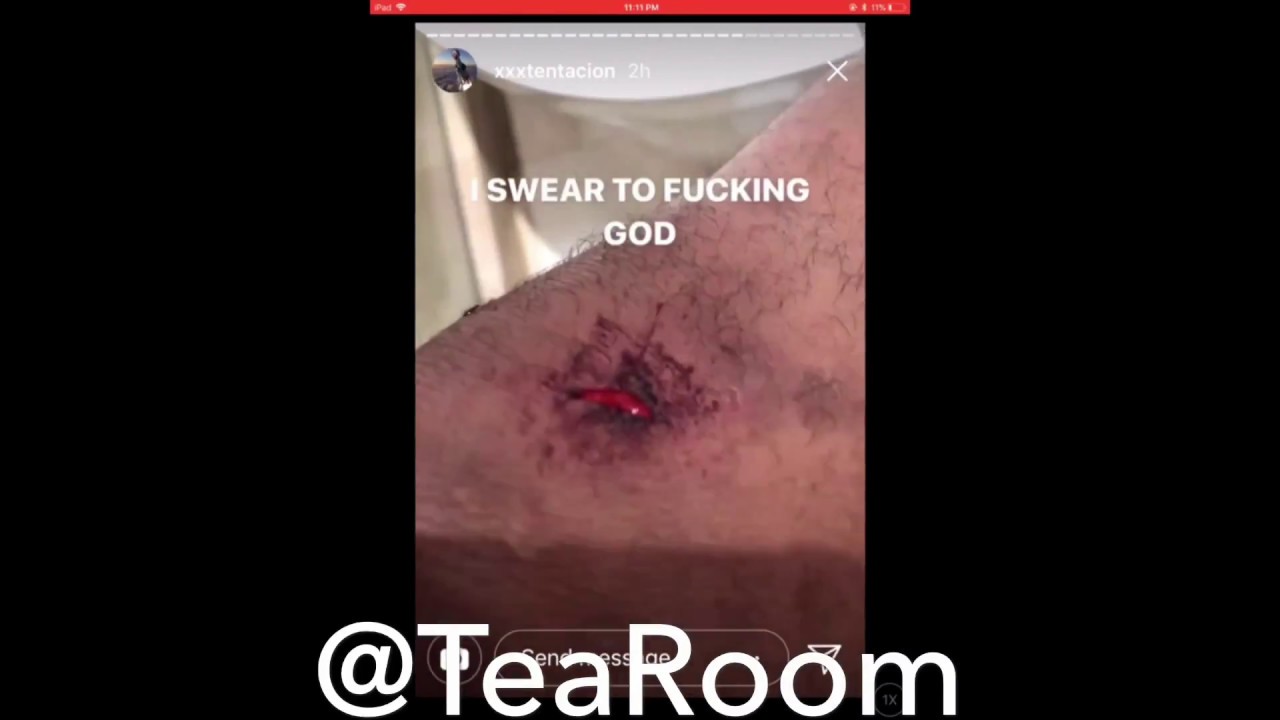 XXXTENTACION GETS JUMPED BY MIGOS!!!