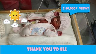 My Baby Born at 35 Weeks Premature Birth