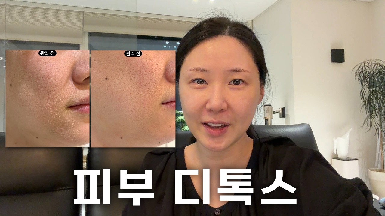 집에서 붉음증,각질 잡는 관리법