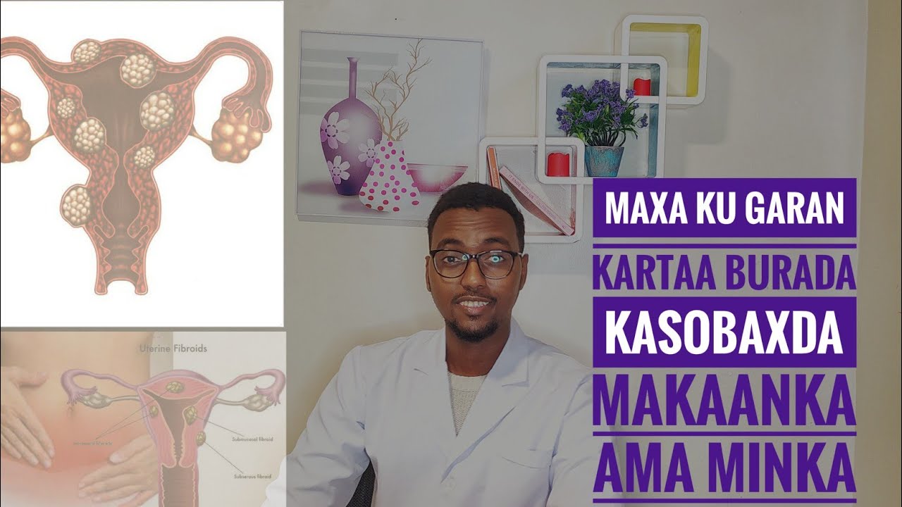 Maxaa ku Garan Kartaa BURADA Kasobaxda Makaankaa|BURADA MAKAANKA|Dr.Sadam