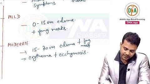 Snake Poisoning I Toxicology I FMT I For NEET-PG  / AIIMS / FMGE By Dr. Vishwajeet Singh