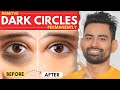 Say GoodBye to These Forever! (Dark Circles, Bloating, Muscle Cramps) | Fit Tuber