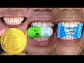Satisfying Chewing ASMR #Compilation #ASMR #DoctorTristanPeh