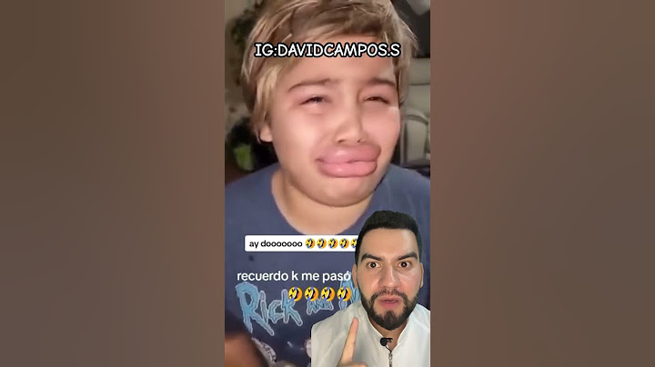 LE QUEDÓ GRANDE LOS LABIOS