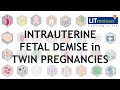 Impact of Chorionicity on Risk and Timing of Intrauterine Fetal Demise in Twin Pregnancies