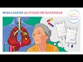 5 - Mon Parcours Poumon : Mon cancer au stade métastatique