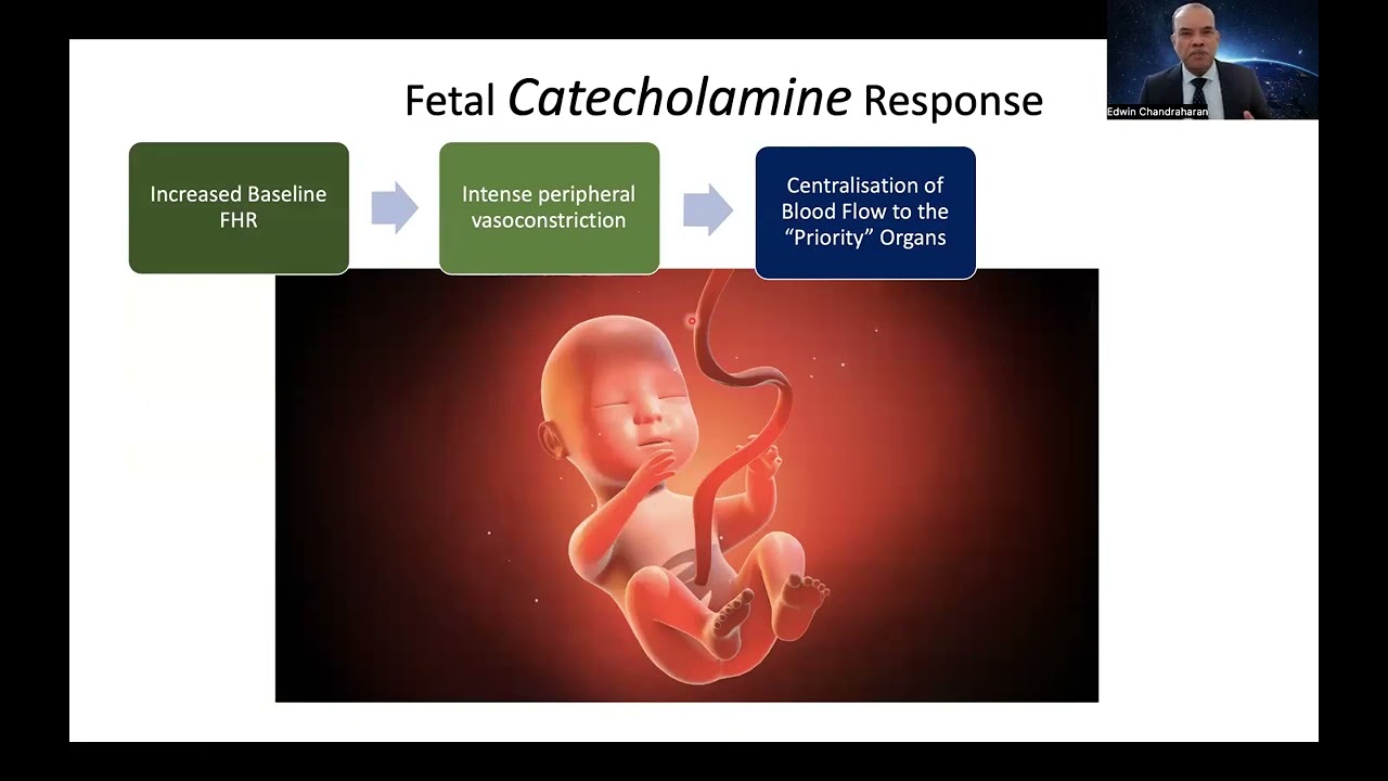 Recognition and Management of Chronic Hypoxia & Pre existing injury on the Cardiotocograph (CTG)
