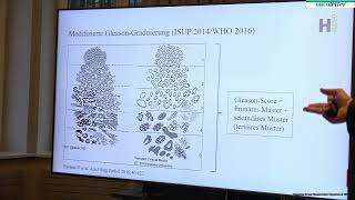 Wolfram Jochum, St. Gallen (CH) (Molekular-) Pathologische Diagnostik