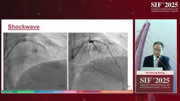 Room A- A2- Rotablating left main: considerations, tips and tricks