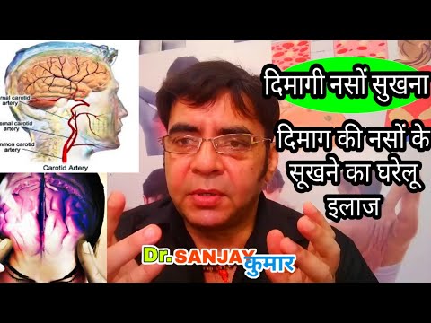 Dimag Ki Naso Ka Sukh Jana | Dimaag ki Naso Ka Sukhapan | Dry Brain Treatment