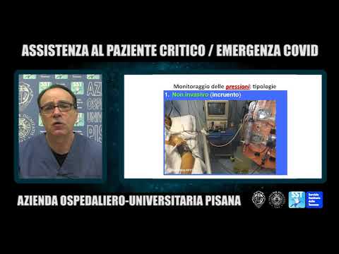 Video: Allarme filo a filo: tipologie, principio di funzionamento. Segnalatore cablaggio nascosto 