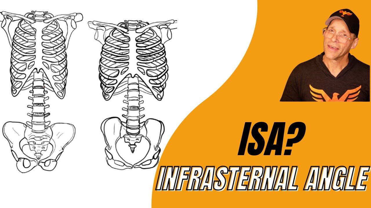 Путаница в подгрудинном углу (ISA) — решена [эп. 76]