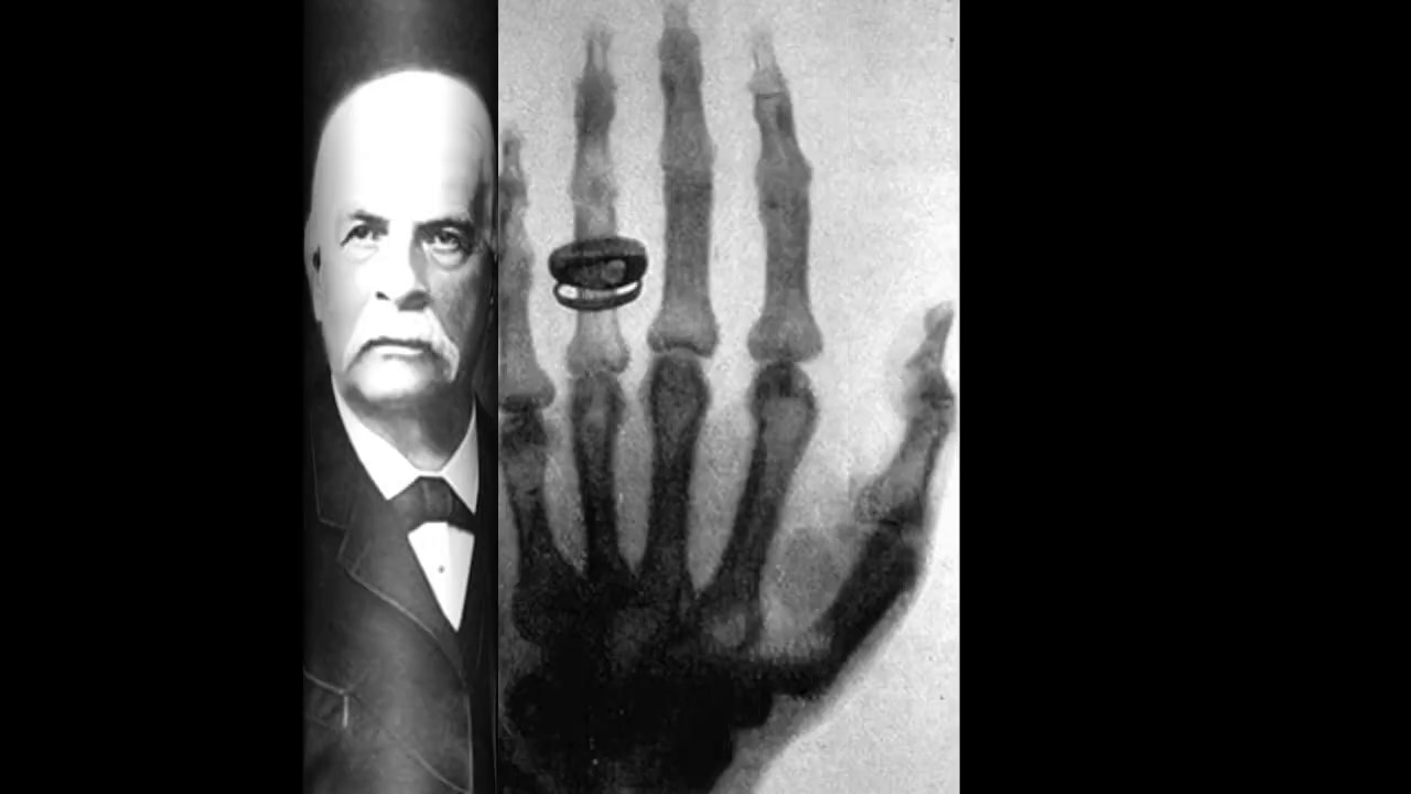 Who invented Xray Tamil SRI HARI HARA PRASATH YouTube