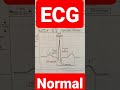 normal ECG #nursing #bscnursing #youtube #staffnurseexam #aiims