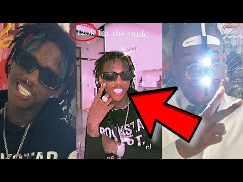 Famous Dex Speaks Codeine Destroying His Teeth 120K For New Ones