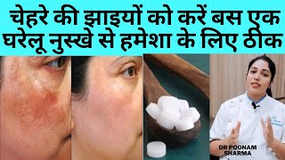 चेहरे की झाइयां और झुर्रियां मिटाने के घरेलु उपाय | Home Remedies To Remove  Wrinkles On face