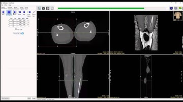 AnalyzePro: Cropping data