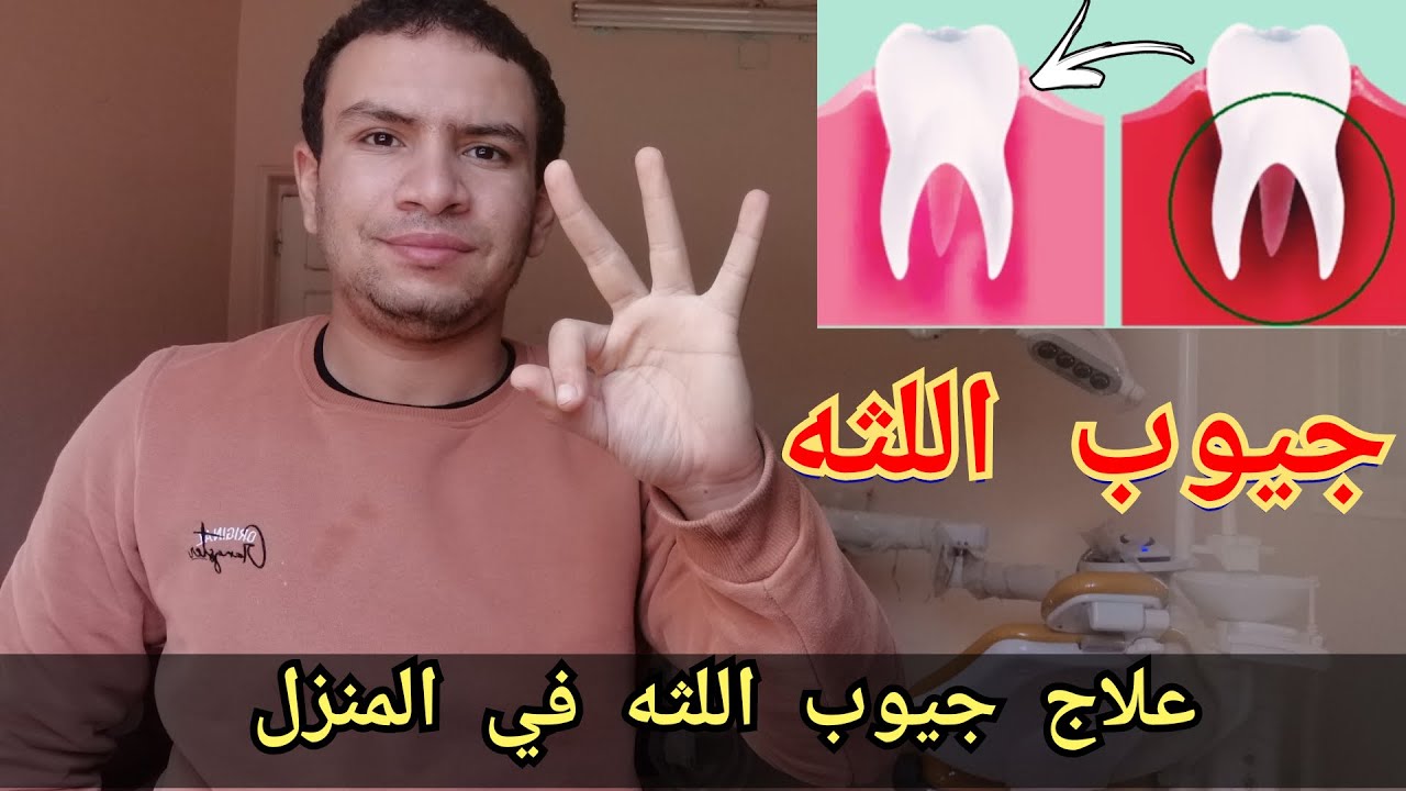 علاج جيوب اللثه في المنزل بدون طبيب ب 3 خطوات