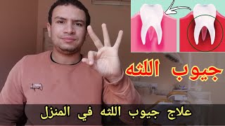 علاج جيوب اللثه في المنزل بدون طبيب ب 3 خطوات