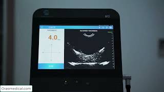 PeakSonic   How to measure bladder wall thickness
