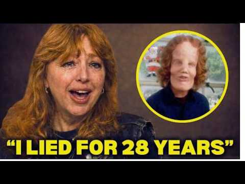 Before She Died, Rocky Dennis's Mom FINALLY Broke Silence About Rocky Dennis And It's BAD