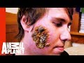 Huge Open Wound on a Young Man's Face | Monsters Inside Me