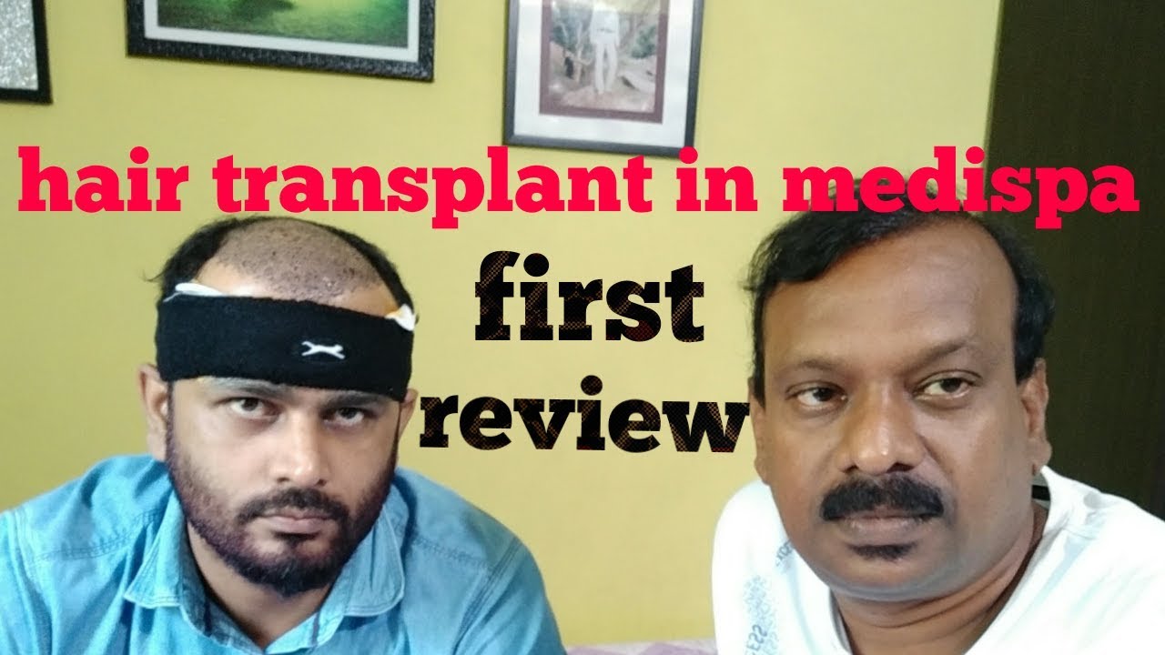 Hair transplant in medispa first review my subscriber...hindi YouTube