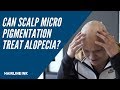 Can Scalp Micropigmentation Help Alopecia? 🤔