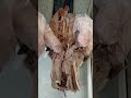 Anatomy: Spotting on a hand specimen (1st yearr MBBS) #shorts #youtubeshorts #youtube #ytshorts