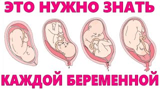 ЗНАЙ ЭТО ПЕРЕД РОДАМИ | Основные вопросы которая должна знать каждая беременная женщина о родах