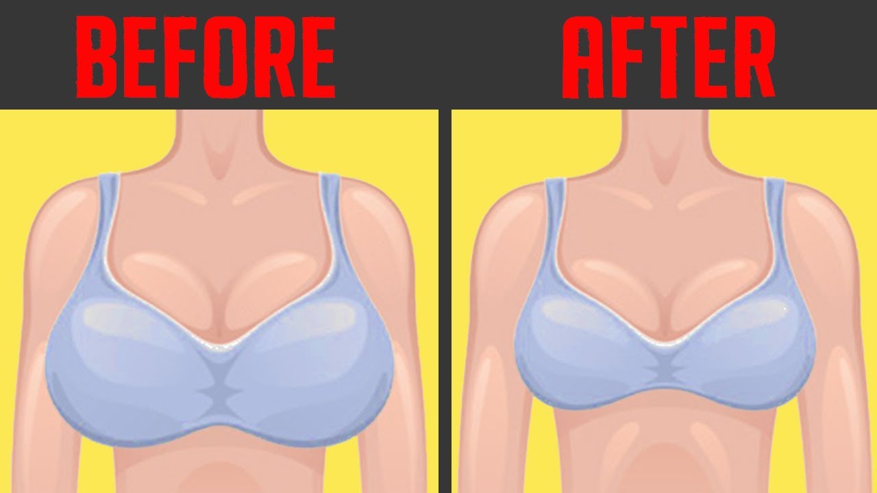 5 Natural Remedies To Reduce Breast Size Quickly At Home Reduce