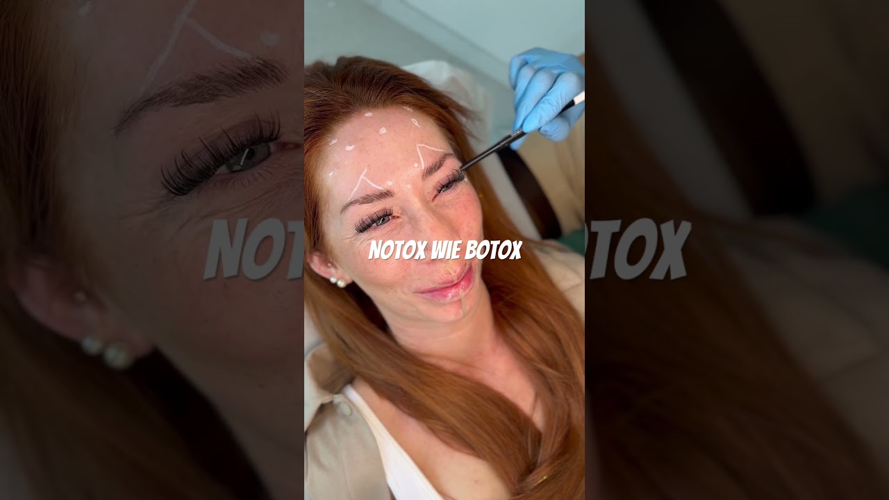 Notox wie Botox