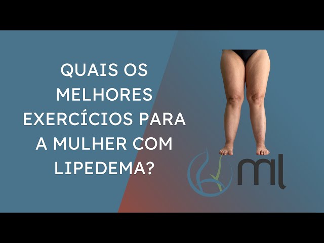 Exercícios para Lipedema! Aprenda e comece hoje mesmo! 