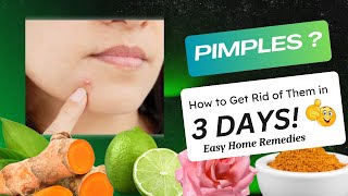 Say Goodbye to PIMPLES in Just 3 Days natural remedies