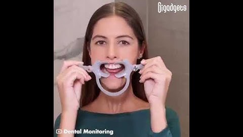 ScanBox is an AI-powered Dental scanner...🦷🥶😬