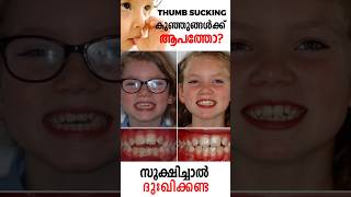 Can Thumb Sucking RUIN Your Child’s Teeth? | Pediatric Dentist Explains the Dangers | In Malayalam